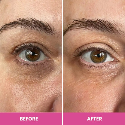 PrimeEyes Hydrate