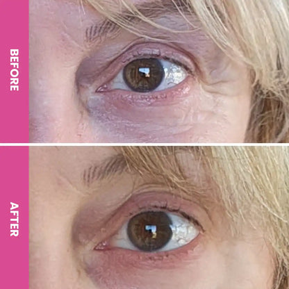 PrimeEyes Hydrate