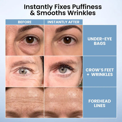 PrimeLift Instant Eye Tightener